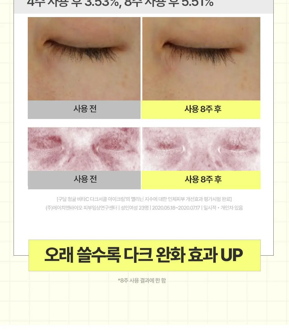 [리뉴얼] 구달 청귤 비타C 잡티케어 아이크림 30ml 1+1 기획 상세페이지 11